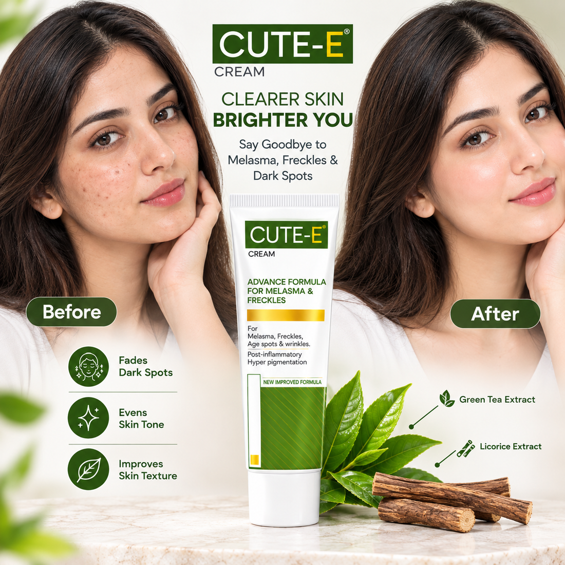 CUTE-E Cream || Advance Formula for Melasma & Freckles