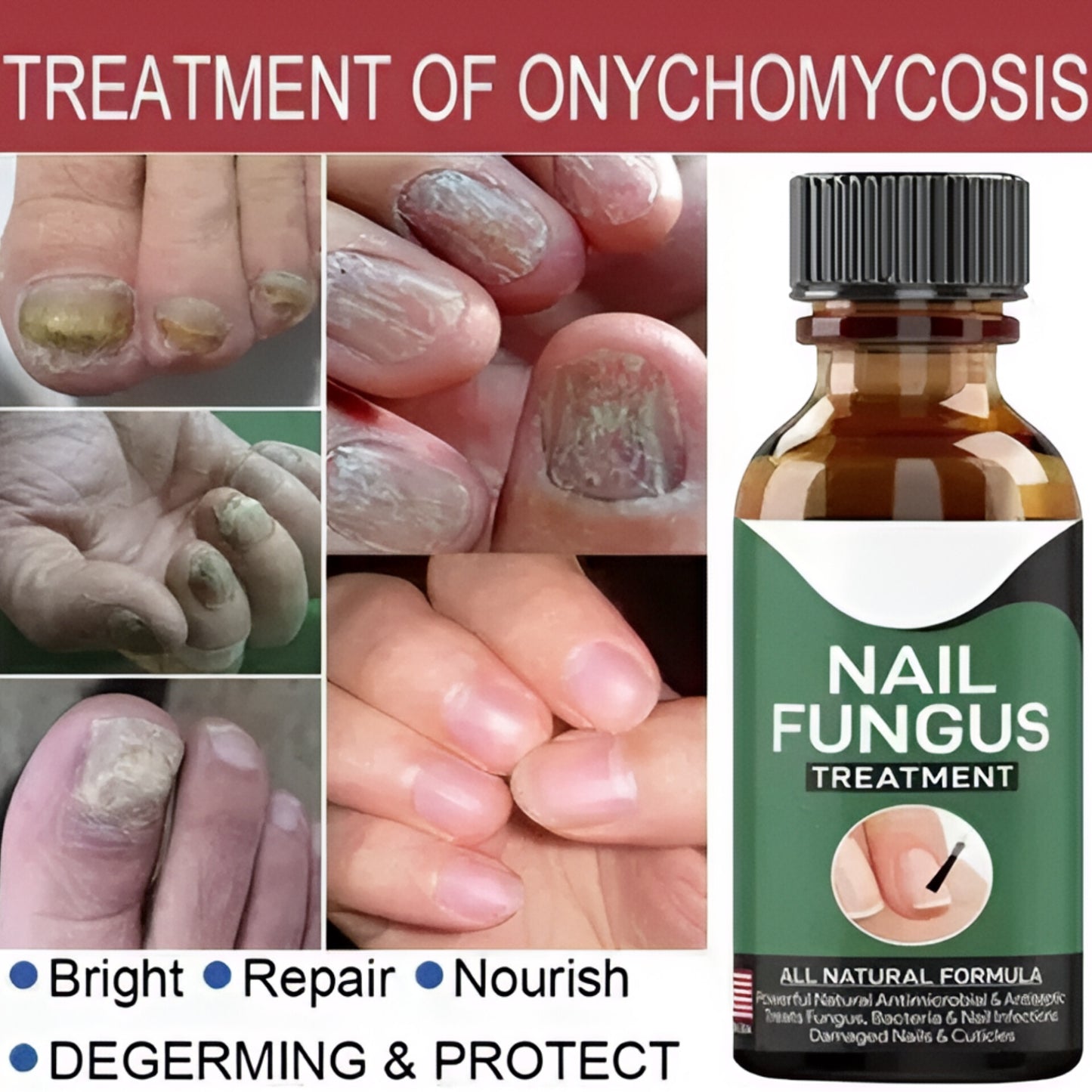 Nail Fungus Repair Serum