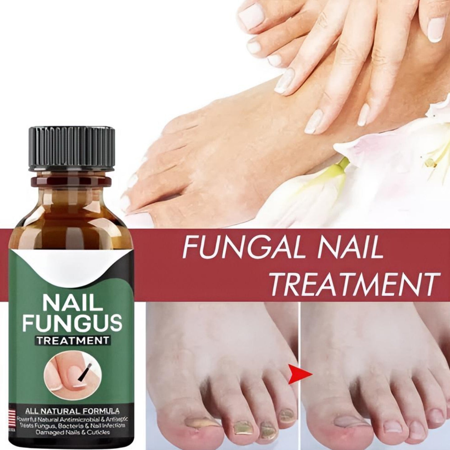 Nail Fungus Repair Serum